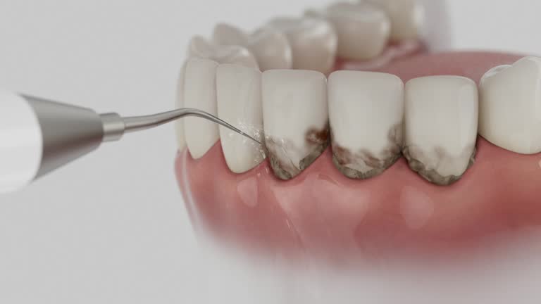 Trusted Dental Crowns And Bridges service in Fox Crossing, WI - Dentist Open Now